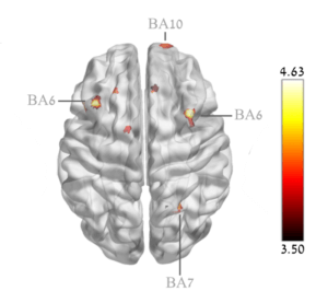 Hyperbaric Oxygen Treatment can improve cognitive performance of healthy aging adults